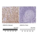 Merck Anti-ANXA10 antibody produced in rabbit