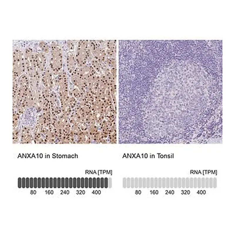 Merck Anti-ANXA10 antibody produced in rabbit