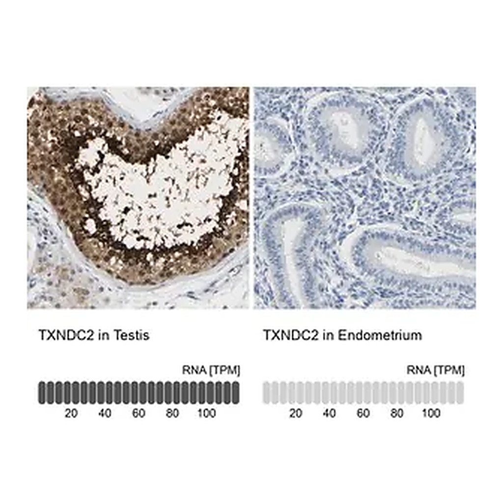 Merck Anti-TXNDC2 antibody produced in rabbit