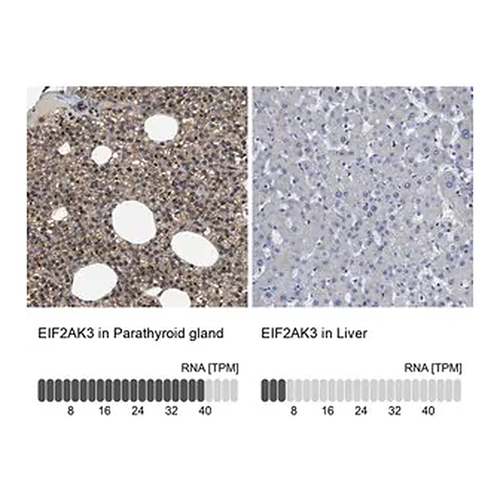 Merck Anti-EIF2AK3 antibody produced in rabbit
