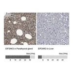 Merck Anti-EIF2AK3 antibody produced in rabbit