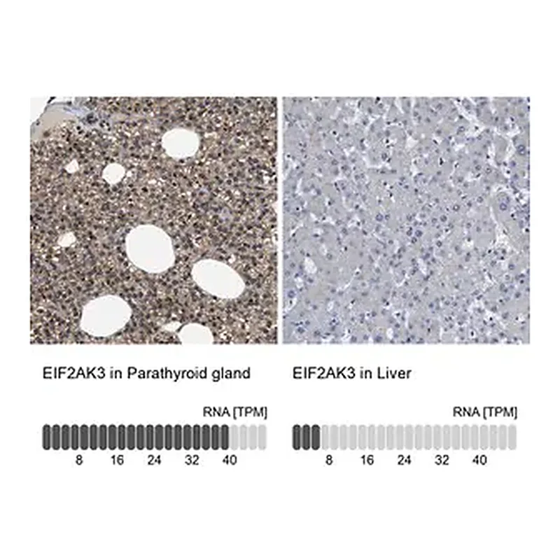 Merck Anti-EIF2AK3 antibody produced in rabbit