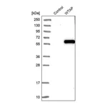 Merck Anti-WTAP antibody produced in rabbit
