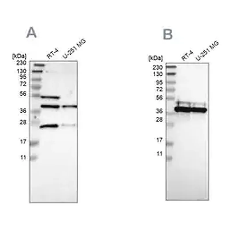 Merck Anti-CCDC51 antibody produced in rabbit