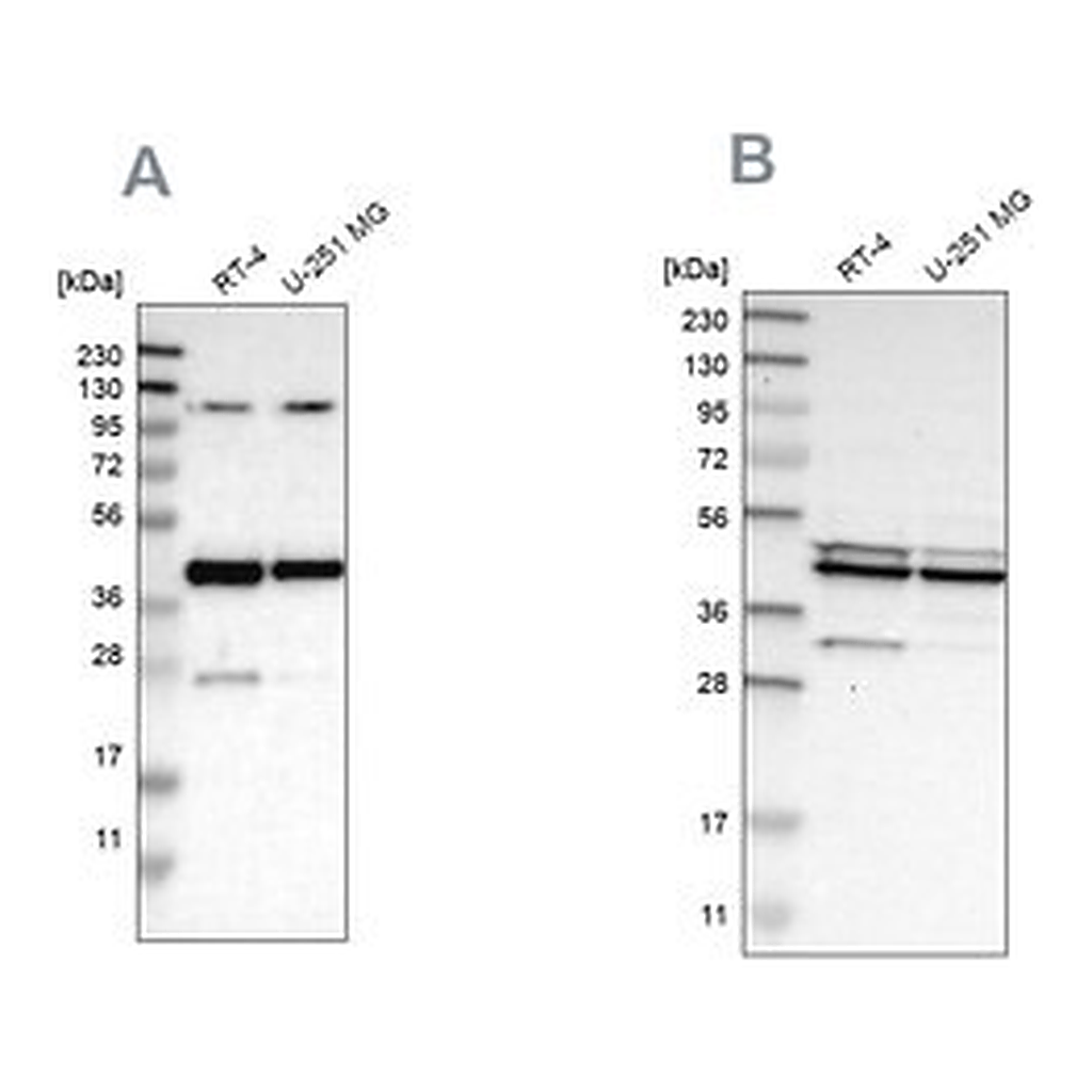 Merck Anti-CFAP36 antibody produced in rabbit