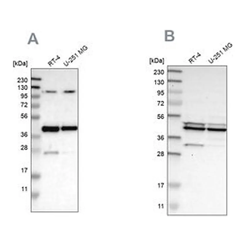 Merck Anti-CFAP36 antibody produced in rabbit