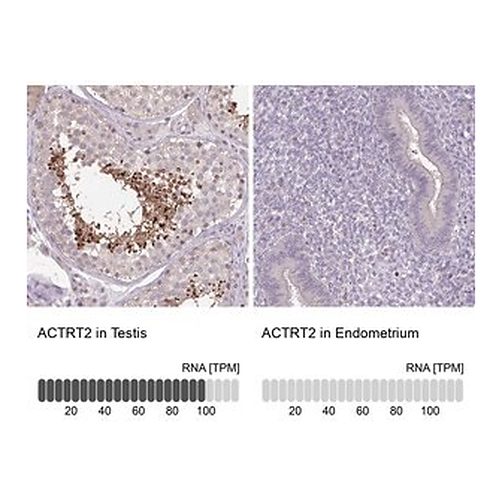 Merck Anti-ACTRT2 antibody produced in rabbit