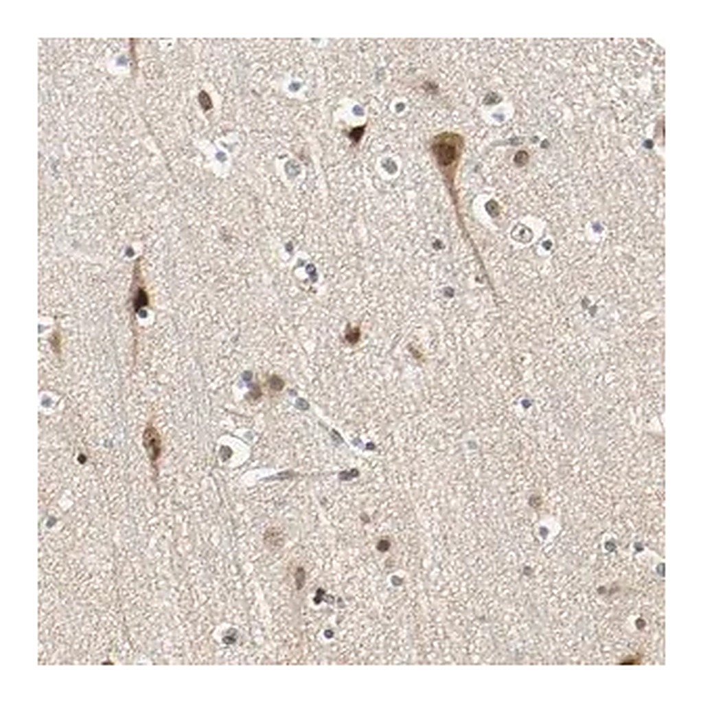 Merck Anti-POGZ antibody produced in rabbit