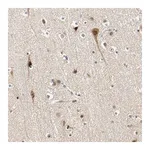 Merck Anti-POGZ antibody produced in rabbit