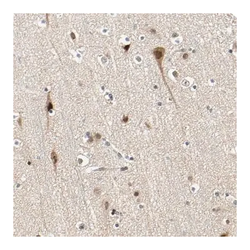 Merck Anti-POGZ antibody produced in rabbit