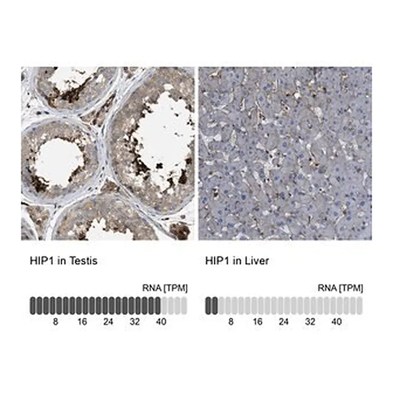 Merck Anti-HIP1 antibody produced in rabbit