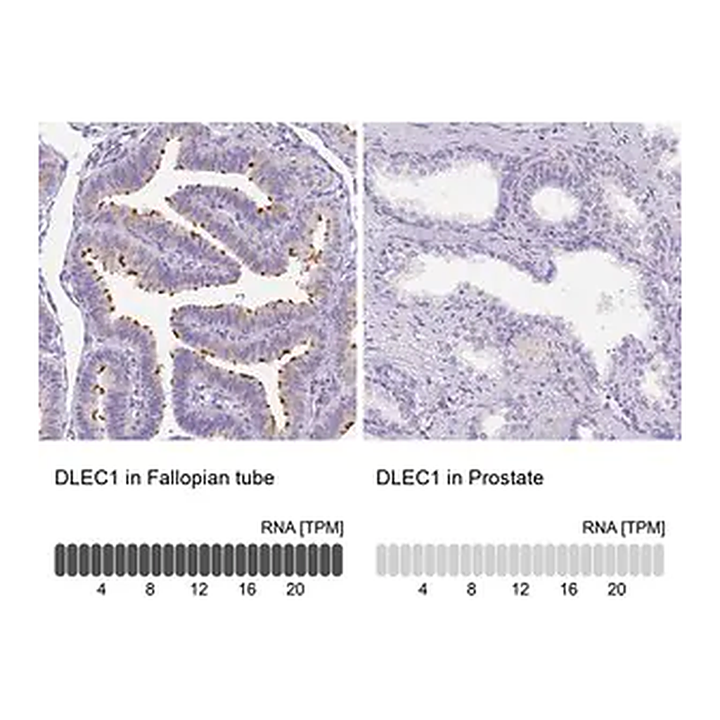 Merck Anti-DLEC1 antibody produced in rabbit