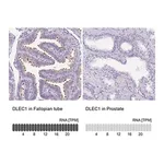 Merck Anti-DLEC1 antibody produced in rabbit