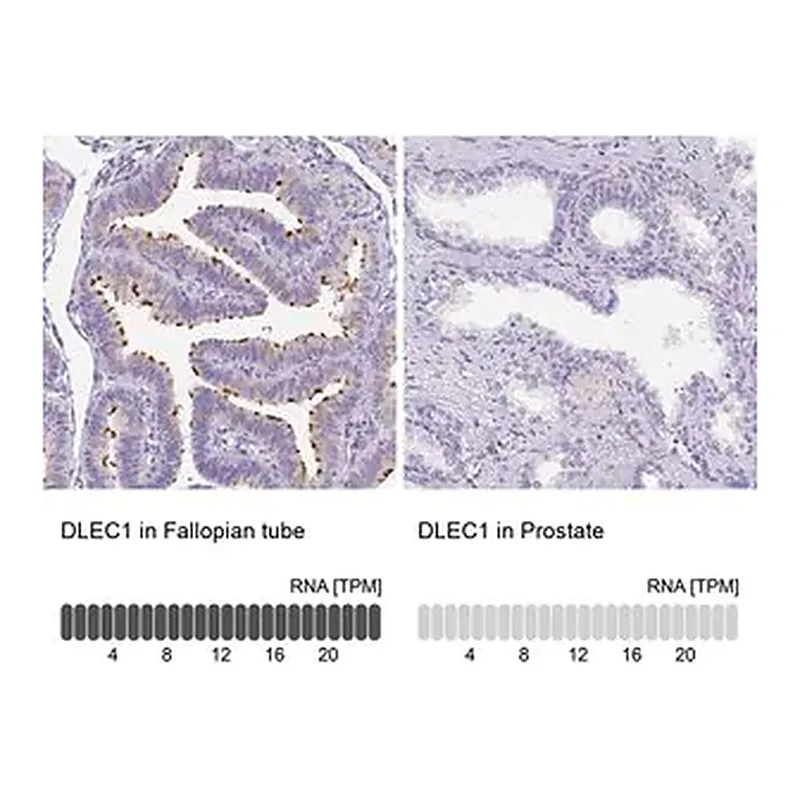 Merck Anti-DLEC1 antibody produced in rabbit