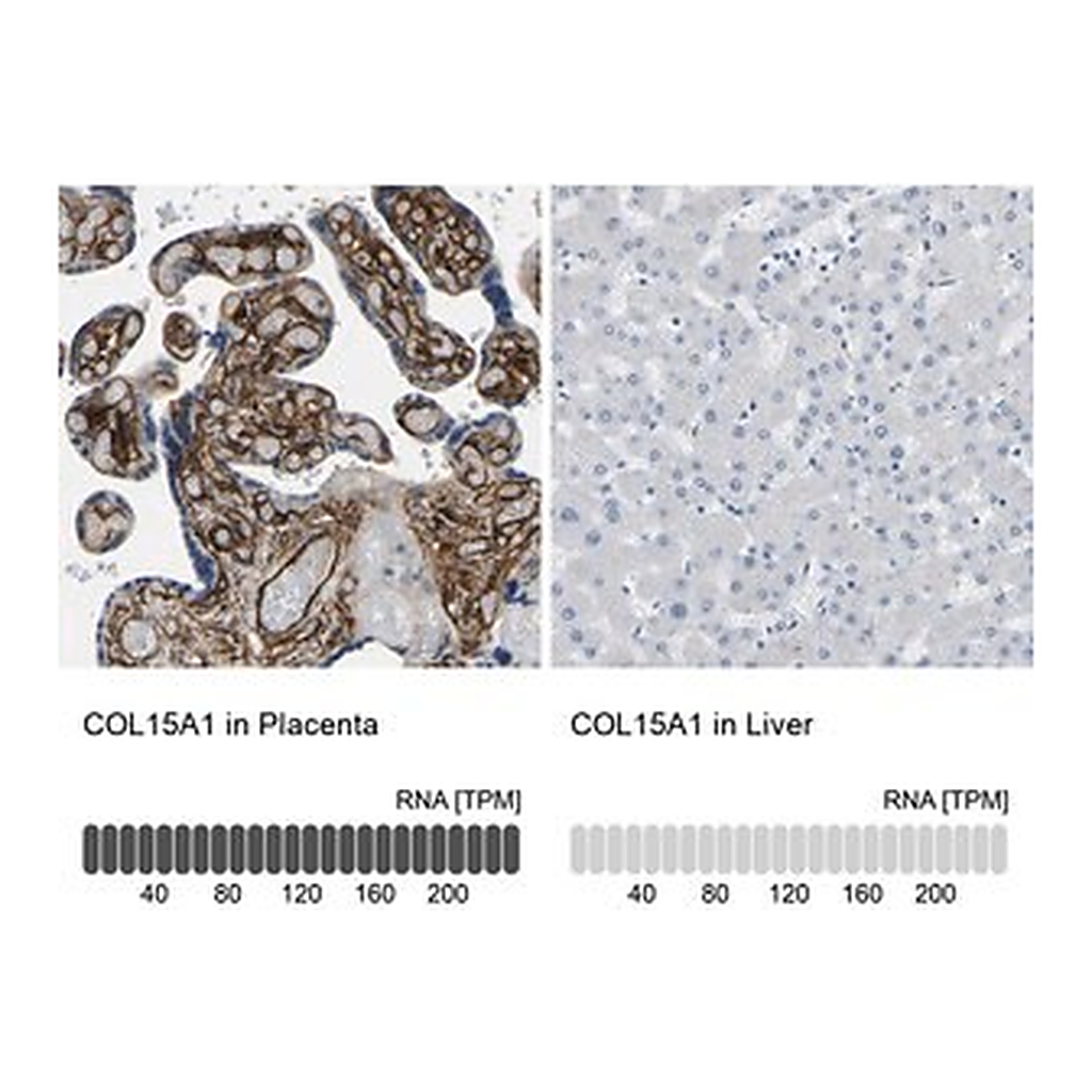 Merck Anti-COL15A1 antibody produced in rabbit
