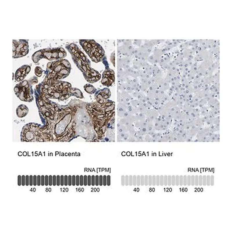 Merck Anti-COL15A1 antibody produced in rabbit