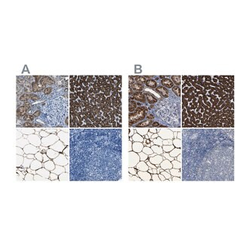 Merck Anti-ACSL1 antibody produced in rabbit