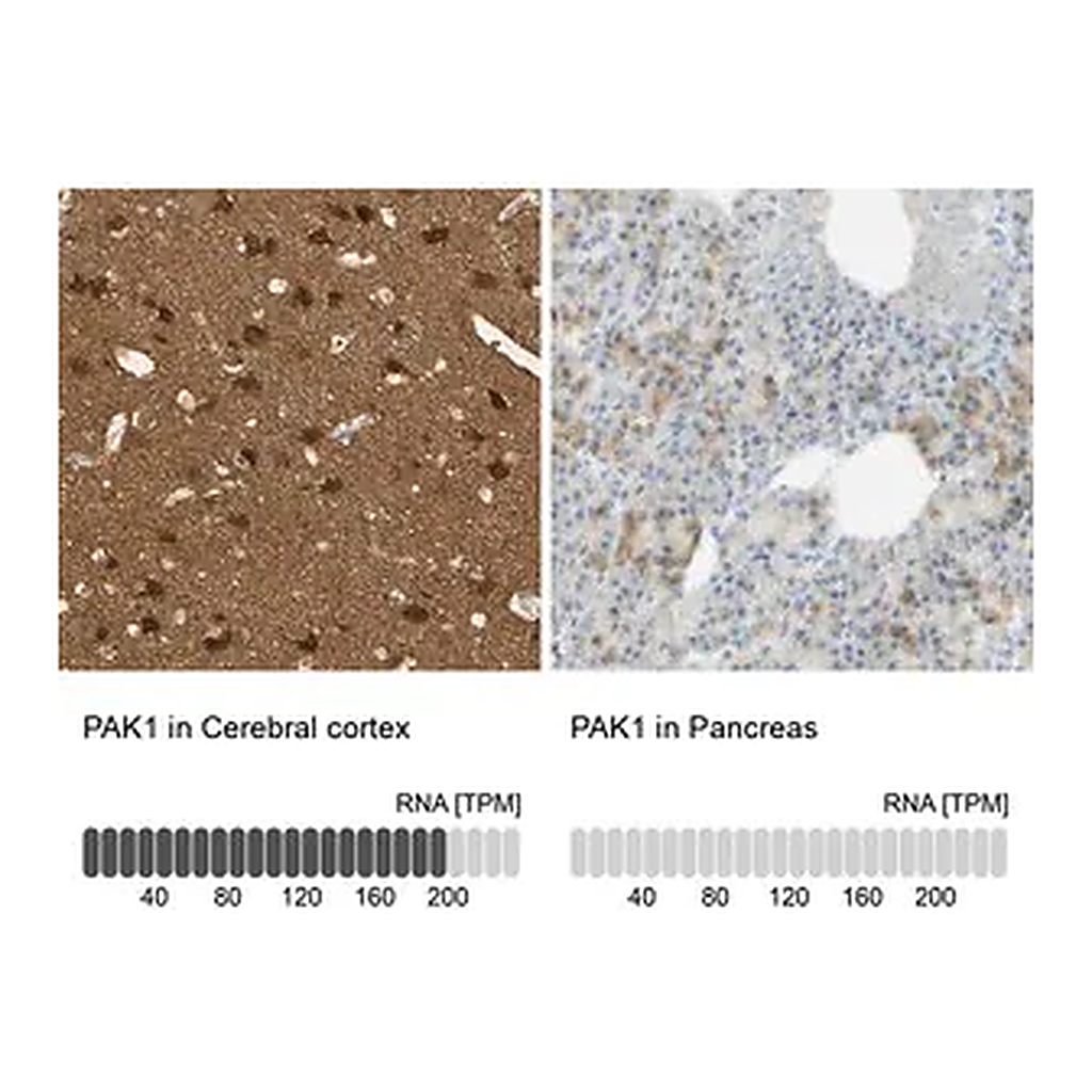 Merck Anti-PAK1 antibody produced in rabbit