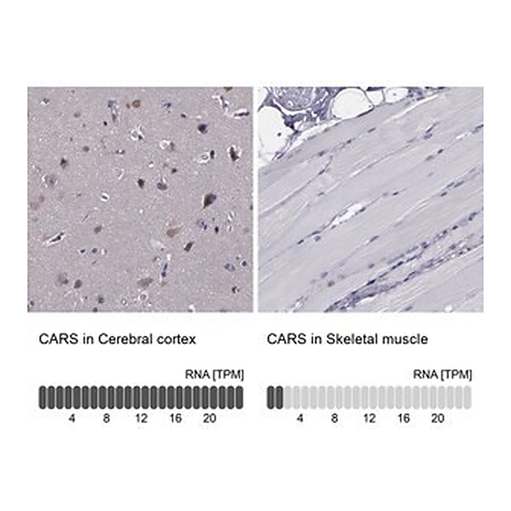 Merck Anti-CARS antibody produced in rabbit