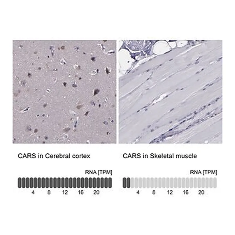 Merck Anti-CARS antibody produced in rabbit