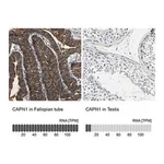 Merck Anti-CAPN1 antibody produced in rabbit