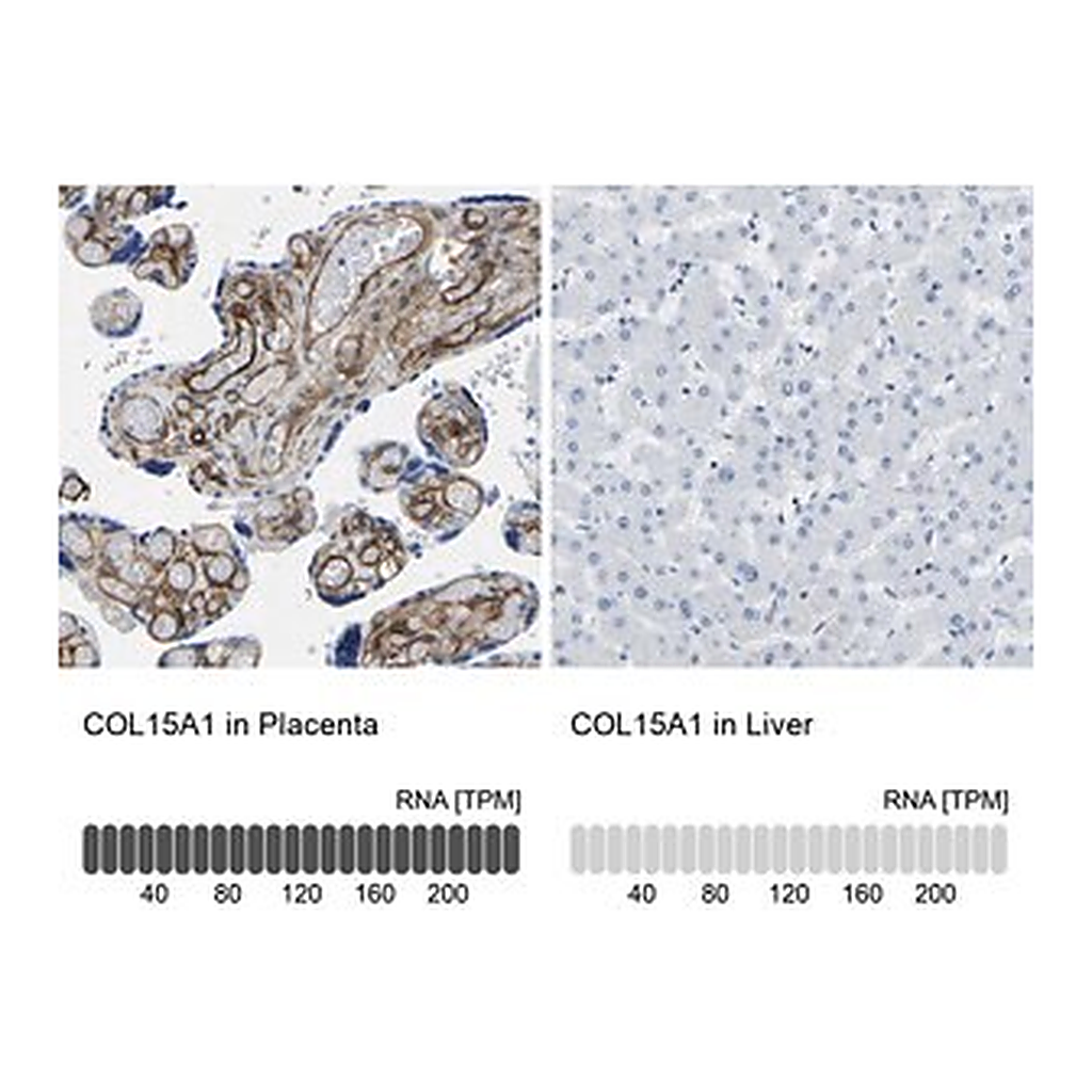 Merck Anti-COL15A1 antibody produced in rabbit
