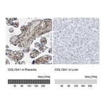 Merck Anti-COL15A1 antibody produced in rabbit