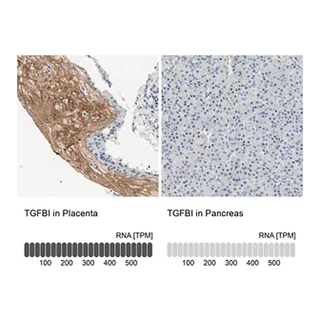 Merck Anti-TGFBI antibody produced in rabbit