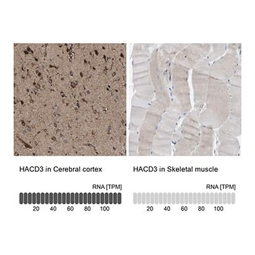 Merck Anti-HACD3 antibody produced in rabbit