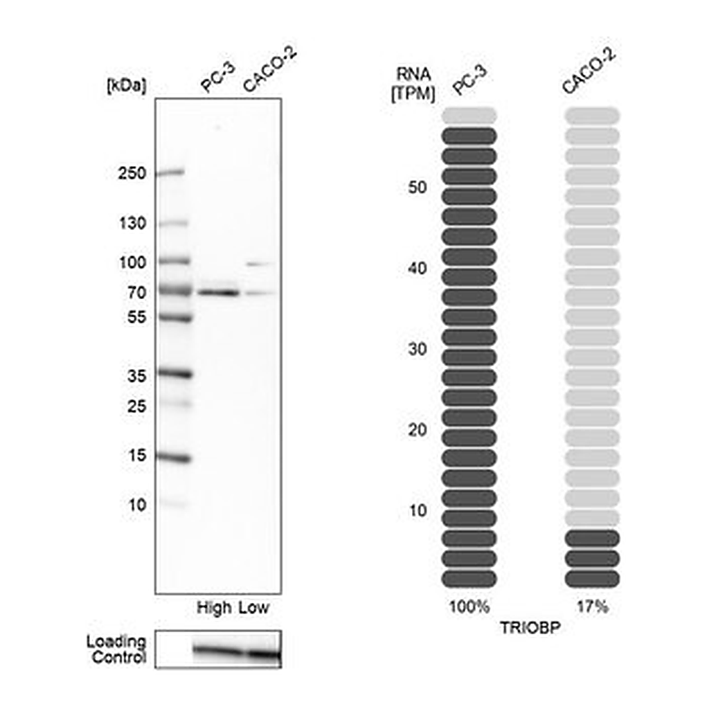 Merck Anti-TRIOBP antibody produced in rabbit