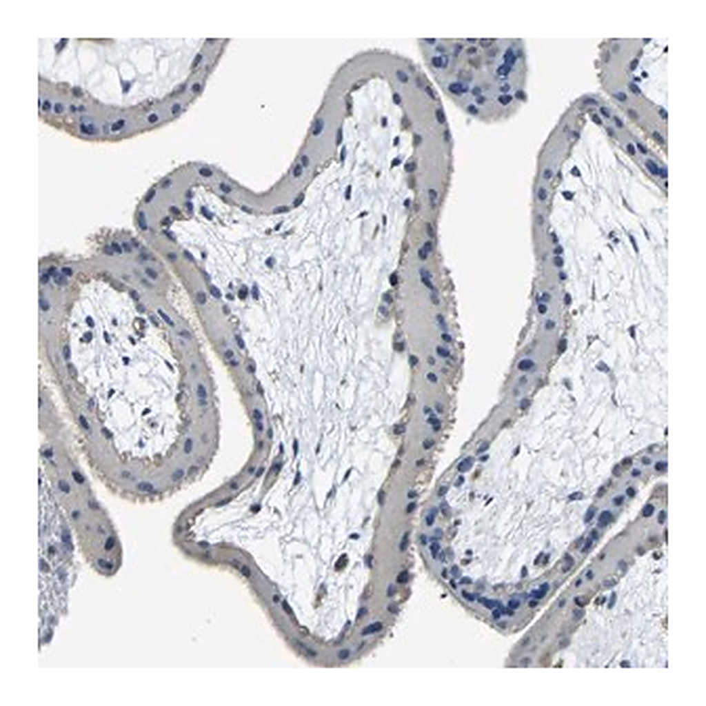 Merck Anti-THSD1 antibody produced in rabbit