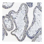Merck Anti-THSD1 antibody produced in rabbit