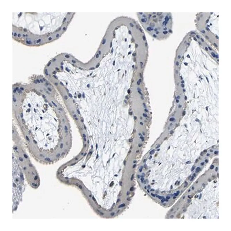 Merck Anti-THSD1 antibody produced in rabbit