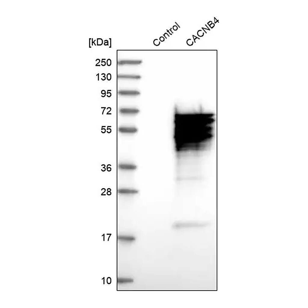 Merck Anti-CACNB4 antibody produced in rabbit