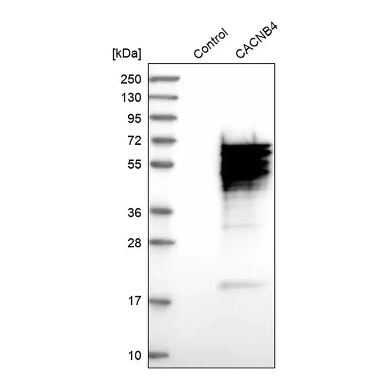 Merck Anti-CACNB4 antibody produced in rabbit
