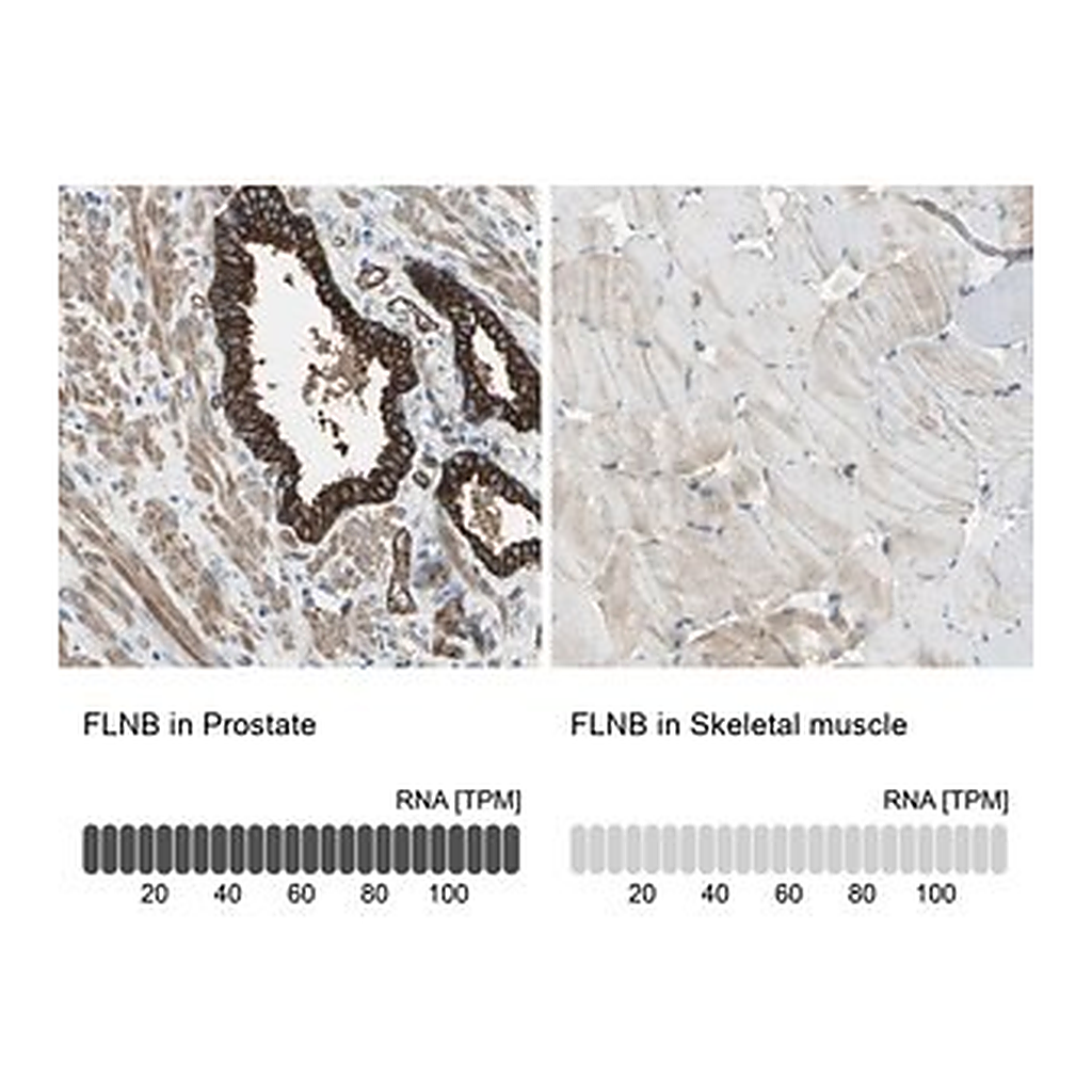 Merck Anti-FLNB antibody produced in rabbit