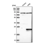 Merck Anti-WRB antibody produced in rabbit
