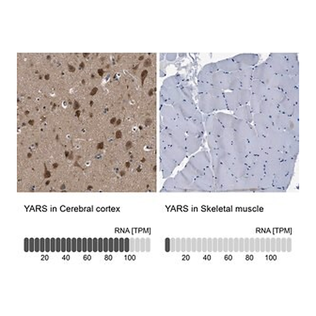Merck Anti-YARS antibody produced in rabbit