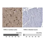 Merck Anti-YARS antibody produced in rabbit