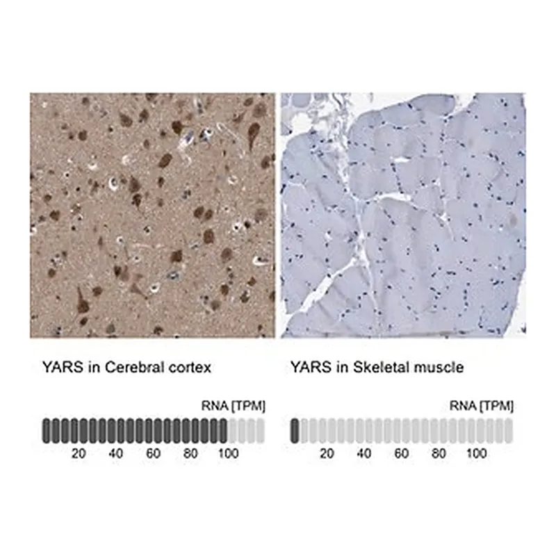 Merck Anti-YARS antibody produced in rabbit