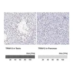 Merck Anti-TRIM13 antibody produced in rabbit