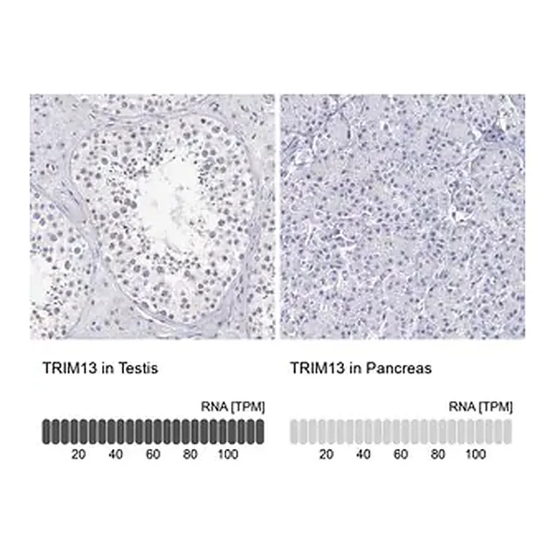 Merck Anti-TRIM13 antibody produced in rabbit