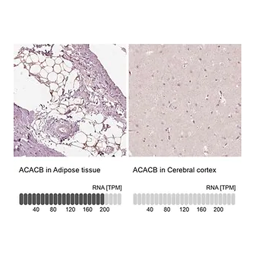 Merck Anti-ACACB antibody produced in rabbit