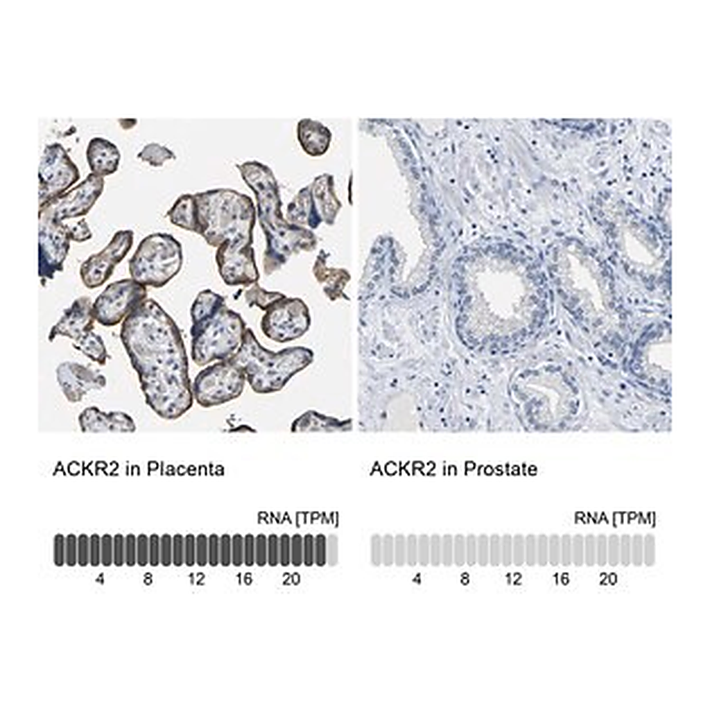 Merck Anti-ACKR2 antibody produced in rabbit