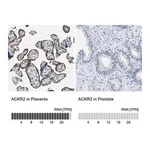 Merck Anti-ACKR2 antibody produced in rabbit