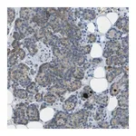 Merck Anti-LGI2 antibody produced in rabbit