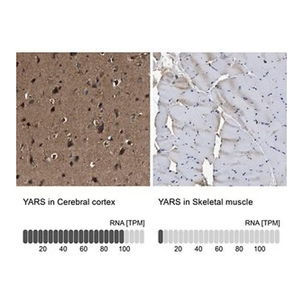 Merck Anti-YARS antibody produced in rabbit