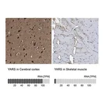 Merck Anti-YARS antibody produced in rabbit