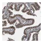 Merck Anti-KAT5 antibody produced in rabbit