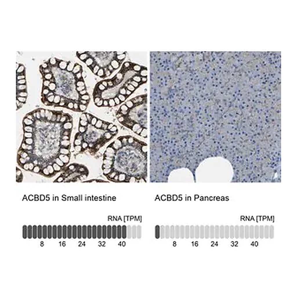 Merck Anti-ACBD5 antibody produced in rabbit